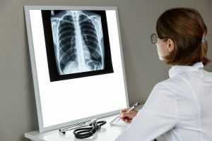 Pulmonologist therapist examining an x-ray of lungs. Health care and medical insurance concept